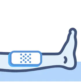 Wound Dressing